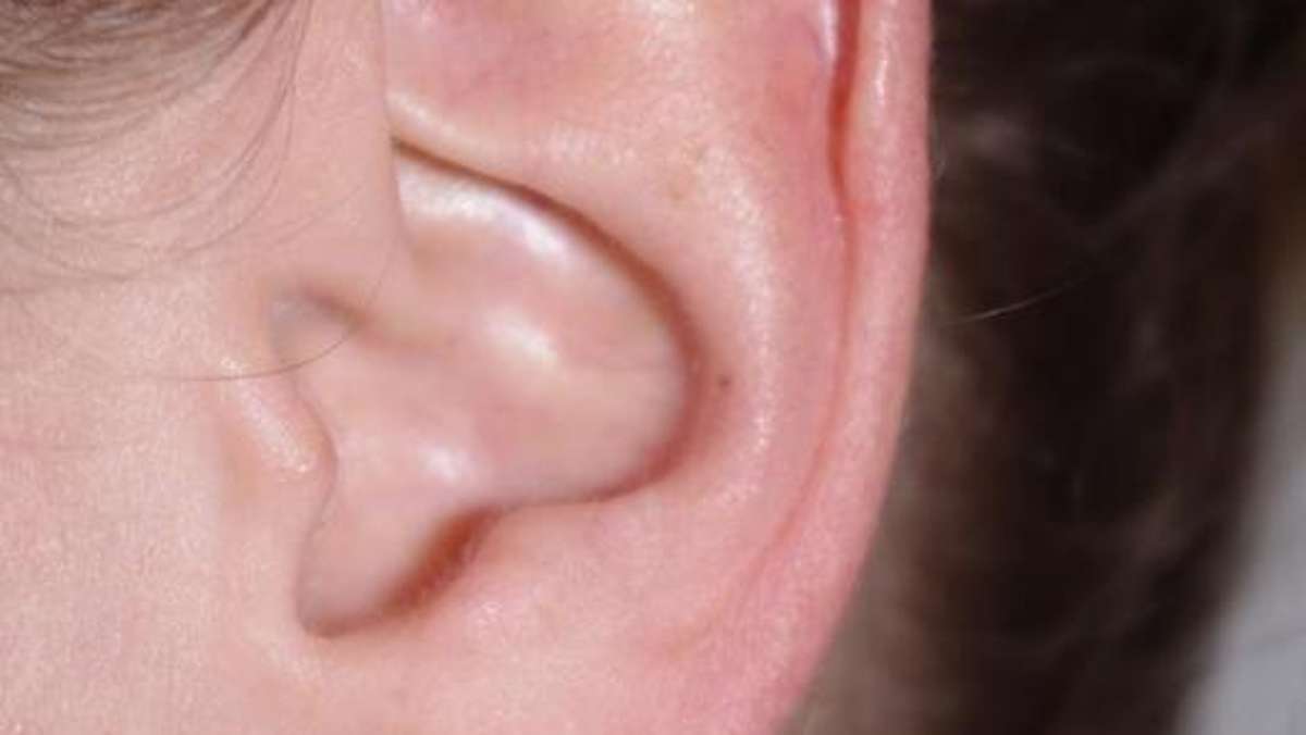 Frage des Tages: Die Sache mit dem entzündeten Ohr