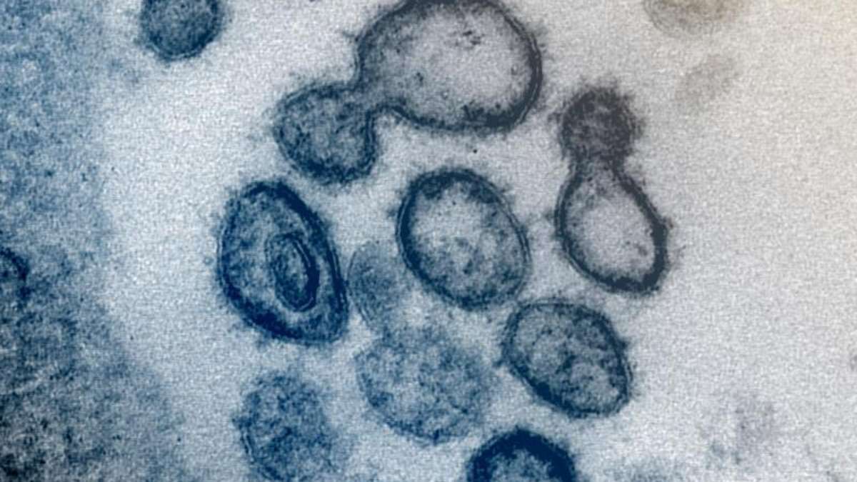 Kulmbach: Coronavirus: Erstes Todesopfer im Landkreis Kulmbach